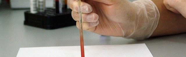 ¿Qué detecta el test prenatal no invasivo?