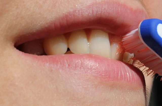 limpieza-dental-IP | CR Diario
